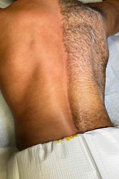 WTC_ServicesPage_BackWaxing_2-768x960