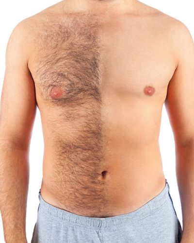 Hairy and shaved male chest highlighting the effects of a hair removal treatment, isolated against a clean white background, showcasing a smooth and well-groomed midsection